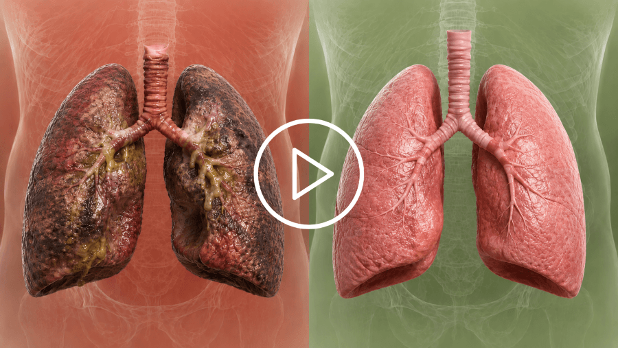 Simple lung restoration method